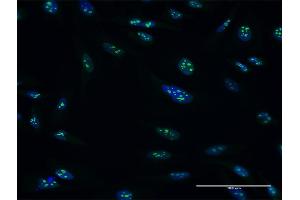 Immunofluorescence of purified MaxPab antibody to PES1 on HeLa cell. (PES1 antibody  (AA 1-588))