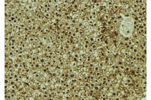 ABIN6273102 at 1/100 staining Mouse liver tissue by IHC-P.