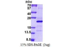 SDS-PAGE (SDS) image for Mitochondrial Ribosomal Protein S25 (MRPS25) (AA 1-173) protein (His tag) (ABIN5853099)