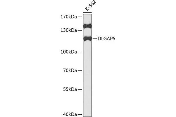 DLGAP5 antibody  (AA 547-846)