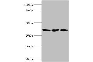 Western blot All lanes: ADP-ribosylation factor GTPase-activating protein 1 antibody at 8 μg/mL Lane 1: PC-3 whole cell lysate Lane 2: Hela whole cell lysate Lane 3: Mouse brain tissue Secondary Goat polyclonal to rabbit IgG at 1/10000 dilution Predicted band size: 45, 46, 32, 40 kDa Observed band size: 45 kDa (ARFGAP1 antibody  (AA 1-220))