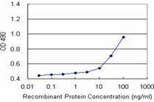 Sandwich ELISA detection sensitivity ranging from 10 ng/mL to 100 ng/mL. (MCAT (Human) Matched Antibody Pair)