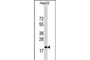Western blot analysis of p27Kip1 Antibody (C-term) 6269b in HepG2 cell line lysates (35 μg/lane). (CDKN1B antibody  (C-Term))