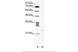 Image no. 1 for anti-BCL2-Related Protein A1 (BCL2A1) (C-Term) antibody (ABIN6736048)