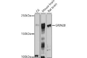Western blot analysis of extracts of various cell lines, using GRIN2B antibody (ABIN3017275, ABIN3017276, ABIN3017277 and ABIN1680110) at 1:1000 dilution.