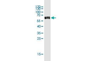 Western Blot detection against Immunogen (61. (SLC7A6OS antibody  (AA 1-309))