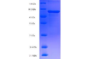 TdT Protein (AA 1-509) (His tag)
