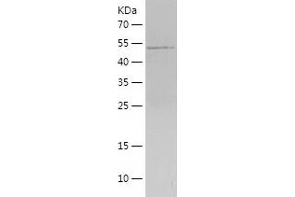 MRPS18B Protein (AA 1-258) (His-IF2DI Tag)