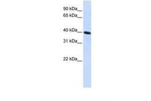 Image no. 1 for anti-Carbohydrate Kinase Domain Containing (Carkd) (AA 144-193) antibody (ABIN6738353) (Carkd antibody  (AA 144-193))