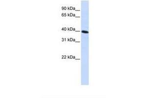 Image no. 1 for anti-Carbohydrate Kinase Domain Containing (Carkd) (AA 144-193) antibody (ABIN6738353)
