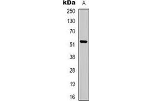 Western blot analysis of MCT12 expression in Jurkat (A) whole cell lysates. (SLC16A12 antibody)