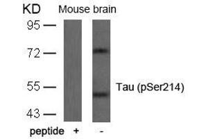 Western blot analysis of extracts from mouse brain tissue using Tau(Phospho-Ser214) Antibody and the same antibody preincubated with blocking peptide. (MAPT antibody  (pSer214))