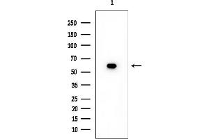 anti-Solute Carrier Family 24 Member 3 (SLC24A3) (Internal Region) antibody