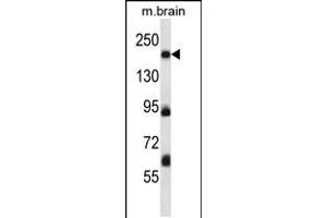 Western blot analysis in mouse brain tissue lysates (35ug/lane). (MAP4K4 antibody  (AA 506-534))