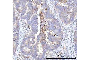 IHC analysis of RBP1 using anti-RBP1 antibody (ABIN7599586). (RBP1 antibody  (AA 10-135))