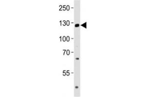 Western blot analysis of lysate from LNCaP cell line using TRPM8 antibody at 1:1000. (TRPM8 antibody  (AA 263-292))