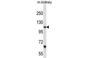 Western Blotting (WB) image for anti-Prostaglandin F2 Receptor Negative Regulator (PTGFRN) antibody (ABIN3000257)