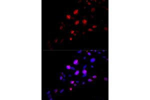 Immunofluorescence analysis of U2OS cells using Rad18 antibody (ABIN6128609, ABIN6146628, ABIN6146630 and ABIN6217430). (RAD18 antibody  (AA 216-495))
