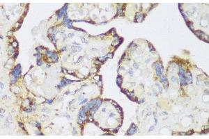 Immunohistochemistry of paraffin-embedded Human placenta using ECH1 Polyclonal Antibody at dilution of 1:150 (40x lens). (ECH1 antibody)