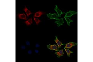 ABIN6262100 and ABIN6268913 staining Hela cells by IF/ICC.