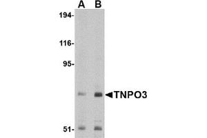 Western blot analysis of TNPO3 in Raji cell lysate with TNPO3 antibody at (A) 1 and (B) 2 μg/ml. (Transportin 3 antibody  (N-Term))