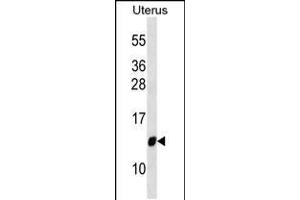 Western blot analysis in Uterus tissue lysates (35ug/lane). (TIMM10 antibody  (AA 21-49))