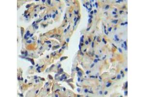 IHC-P analysis of lung tissue, with DAB staining. (TNC antibody  (AA 174-621))