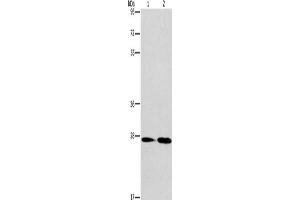 Gel: 8 % SDS-PAGE, Lysate: 40 μg, Lane 1-2: Mouse kidney tissue, Mouse liver tissue, Primary antibody: ABIN7130344(NAT8 Antibody) at dilution 1/237. (NAT8 antibody)
