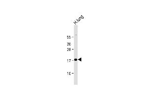 Anti-RARRES2 Antibody (N-Term) at 1:2000 dilution + Human lung lysate Lysates/proteins at 20 μg per lane.