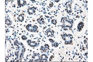 Immunohistochemical staining of paraffin-embedded breast tissue using anti-LEMD3 mouse monoclonal antibody.