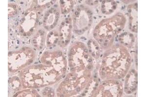 IHC-P analysis of Human Kidney Tissue, with DAB staining. (Connexin 43/GJA1 antibody  (AA 180-382))
