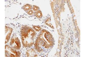 IHC-P Image Immunohistochemical analysis of paraffin-embedded human gastric , using GLOD4, antibody at 1:100 dilution. (GLOD4 antibody)