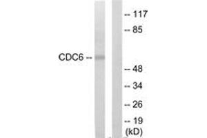 Western blot analysis of extracts from K562 cells, using CDC6 Antibody. (CDC6 antibody  (AA 491-540))