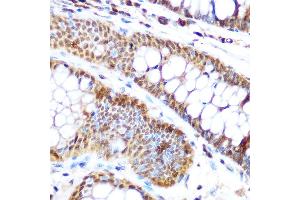 Immunohistochemistry of paraffin-embedded human colon using SP3 Rabbit pAb (ABIN6130701, ABIN6148314, ABIN6148315 and ABIN6216542) at dilution of 1:100 (40x lens). (Sp3 antibody  (AA 240-350))