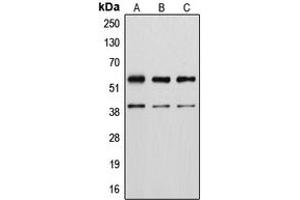 Western blot analysis of Vimentin (pS56) expression in MCF7 UV-treated (A), A10 (B), KNRK (C), NIH3T3 UV-treated (D), H9C2 UV-treated (E) whole cell lysates. (Vimentin antibody  (N-Term, pSer56))