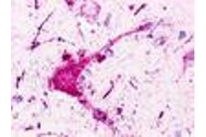 Immunohistochemistry (IHC) image for anti-Purinergic Receptor P2Y, G-Protein Coupled, 1 (P2RY1) (Extracellular Domain) antibody (ABIN1049200)
