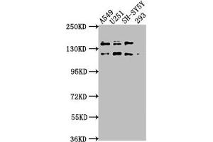 Western Blot Positive WB detected in: A549 whole cell lysate, U251 whole cell lysate, SH-SY5Y whole cell lysate, 293 whole cell lysate All lanes: TAOK1 antibody at 1:2000 Secondary Goat polyclonal to rabbit IgG at 1/50000 dilution Predicted band size: 117, 47, 98 kDa Observed band size: 117 kDa (TAO Kinase 1 (TAOK1) (AA 400-659) antibody)