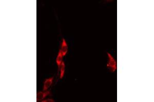 ABIN6274612 staining HeLa by IF/ICC. (HCCS antibody  (Internal Region))