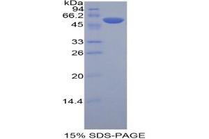 SDS-PAGE analysis of Human KIR3DL2 Protein.