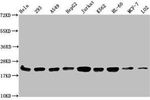 Western Blot Positive WB detected in: Hela whole cell lysate, 293 whole cell lysate, A549 whole cell lysate, HepG2 whole cell lysate, Jurkat whole cell lysate, K562 whole cell lysate, HL60 whole cell lysate, MCF-7 whole cell lysate, LO2 whole cell lysate All lanes: HIST1H1C antibody at 1:500 Secondary Goat polyclonal to rabbit IgG at 1/40000 dilution Predicted band size: 22 kDa Observed band size: 22 kDa (HIST1H1C antibody  (meLys186))