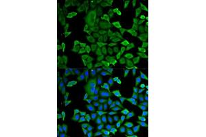 Immunofluorescence analysis of MCF-7 cells using GAPDH antibody. (GAPDH antibody  (AA 1-335))