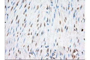 Immunohistochemical staining of paraffin-embedded Human colon tissue using anti-EIF2S1 mouse monoclonal antibody. (EIF2S1 antibody)