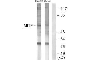 Western blot analysis of extracts from HepG2 cells (lane 1) and COLO205 cells (lane 2), using MITF (epitope around residue 180/73) antibody. (MITF antibody  (Ser73, Ser180))