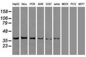 Image no. 2 for anti-DNA Fragmentation Factor, 45kDa, alpha Polypeptide (DFFA) antibody (ABIN1498772)