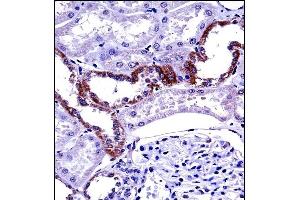 MCOLN1 Antibody (C-term) ((ABIN657474 and ABIN2846502))immunohistochemistry analysis in formalin fixed and paraffin embedded human kidney tissue followed by peroxidase conjugation of the secondary antibody and DAB staining. (MCOLN1 antibody  (C-Term))