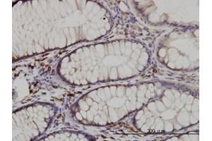 Image no. 2 for anti-CDK5 Regulatory Subunit Associated Protein 3 (CDK5RAP3) (AA 1-507) antibody (ABIN599311) (CDK5RAP3 antibody  (AA 1-507))