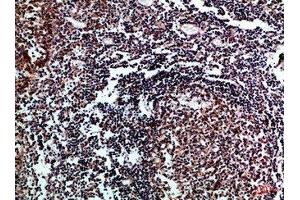Immunohistochemical analysis of paraffin-embedded Human-tonsil, antibody was diluted at 1:100 (IL17D antibody  (AA 141-190))