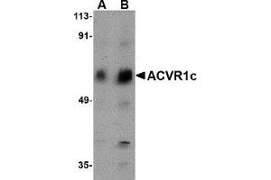 Western Blotting (WB) image for anti-Activin Receptor Type 1C (ACVR1C) (N-Term) antibody (ABIN1031213) (ACVR1C/ALK7 antibody  (N-Term))