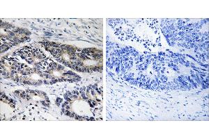 Peptide - + (CYP2R1 antibody)