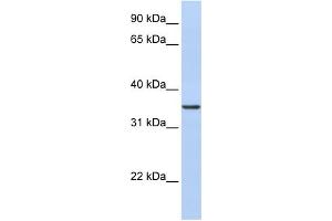 WB Suggested Anti-CDC42EP4 Antibody Titration: 0. (CDC42EP4 antibody  (N-Term))